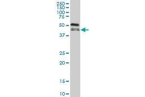 RBM9 monoclonal antibody (M02), clone 5E11 Western Blot analysis of RBM9 expression in A-431 . (RBM9 antibody  (AA 1-100))