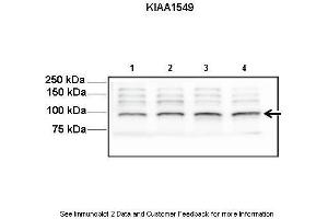 Lanes:   Lane1-4: 30ug mouse neurosphere lysate  Primary Antibody Dilution:   1:1000  Secondary Antibody:   Anti-rabbit HRP  Secondary Antibody Dilution:   1:5000  Gene Name:   KIAA1549  Submitted by:   Yi-Hsien Chen, Washington University School of Medicine (KIAA1549 antibody  (C-Term))