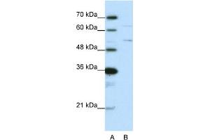 WB Suggested Anti-HNRPK Antibody Titration:  0. (HNRNPK antibody  (N-Term))