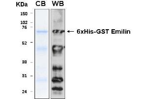 10% SDS-PAGE stained with Coomassie Blue (CB), immunobloting with anti-6xHis (WB) serum and peptide fingerprinting by MALDI-TOF-TOF mass spectrometry (Emilin1 Protein (AA 676-1016) (His-GST))