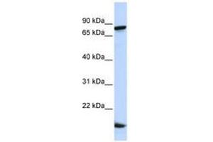 Image no. 1 for anti-Zinc Finger Protein 281 (ZNF281) (C-Term) antibody (ABIN6740570)
