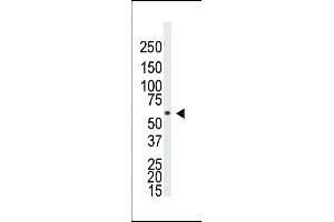 Western blot analysis of anti-BR1A Pab ap2004a in Saos-2 cell lysate. (BMPR1A antibody  (N-Term))