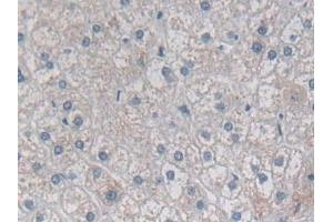 Immunohistochemistry (IHC) image for anti-Desmoplakin (DSP) (AA 2609-2822) antibody (ABIN7434746)
