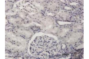 Image no. 1 for anti-PR Domain Containing 4 (PRDM4) (AA 476-576) antibody (ABIN599168) (PRDM4 antibody  (AA 476-576))