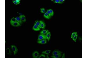 Immunofluorescence staining of HepG2 cells with ABIN7158130 at 1:133, counter-stained with DAPI. (LGR5 antibody  (AA 241-352))