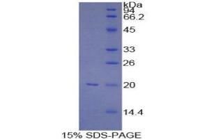 SDS-PAGE (SDS) image for Baculoviral IAP Repeat-Containing 5 (BIRC5) (AA 1-142) protein (His tag) (ABIN1099490) (Survivin Protein (AA 1-142) (His tag))