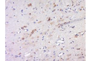 Paraformaldehyde-fixed, paraffin embedded rat brain, Antigen retrieval by boiling in sodium citrate buffer (pH6) for 15min, Block endogenous peroxidase by 3% hydrogen peroxide for 30 minutes, Blocking buffer (normal goat serum) at 37°C for 20min, Antibody incubation with Inhibin Beta C Polyclonal Antibody, Unconjugated  at 1:200 overnight at 4°C, followed by a conjugated secondary and DAB staining. (INHBC antibody  (AA 237-352))