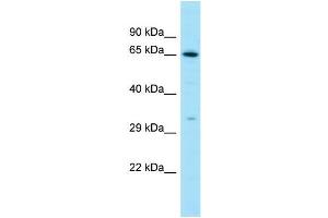 Western Blotting (WB) image for anti-Luteinizing Hormone/Choriogonadotropin Receptor (LHCGR) (C-Term) antibody (ABIN2788657)