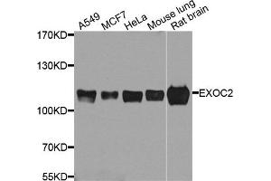 Western blot analysis of extract of various cells, using EXOC2 antibody. (EXOC2 antibody)