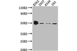 Western Blot Positive WB detected in: K562 whole cell lysate, 293T whole cell lysate, A549 whole cell lysate, HEK293 whole cell lysate All lanes: Wilms Tumor Protein antibody at 1:1000 Secondary Goat polyclonal to rabbit IgG at 1/50000 dilution Predicted band size: 50, 48, 48, 49, 35, 57, 56, 34 kDa Observed band size: 50 kDa (Recombinant WT1 antibody)