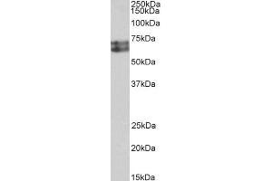 ABIN5539539 (0. (HDC antibody  (AA 449-462))
