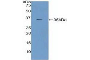 Detection of Recombinant FCN1, Mouse using Polyclonal Antibody to Ficolin 1 (FCN1) (FCN1 antibody  (AA 25-317))