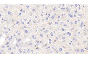 Detection of LOXL2 in Mouse Liver Tissue using Polyclonal Antibody to Lysyl Oxidase Like Protein 2 (LOXL2) (LOXL2 antibody  (AA 53-160))