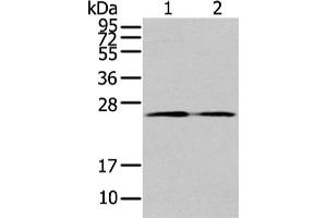 Gel: 12 % SDS-PAGE, Lysate: 40 μg, Lane 1-2: PC3 cell and human colon cancer tissue, Primary antibody: ABIN7192958(TUSC1 Antibody) at dilution 1/200 dilution, Secondary antibody: Goat anti rabbit IgG at 1/8000 dilution, Exposure time: 1 minute (TUSC1 antibody)