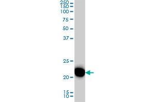 RRAS monoclonal antibody (M01), clone 2E12 Western Blot analysis of RRAS expression in HeLa . (R-Ras antibody  (AA 109-218))