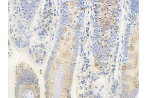 ABIN6258278 and ABIN6273860 at 1/100 staining human normal colon tissue by IHC-P.