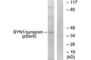 Western blot analysis of extracts from 293 cells treated with PMA 200nM 30', using Synapsin (Phospho-Ser9) Antibody.