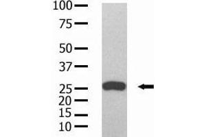 The anti-GST Mab (ABIN387751 and ABIN2843190) is used in Western blot to detect GST recombinant protein purified from bacterial lysate. (GST-Tag antibody)