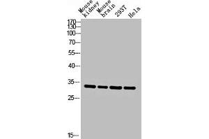 Western blot analysis of Mouse-kidney mouse-brain 293T hela lysis using CA II antibody. (CA2 antibody  (C-Term))