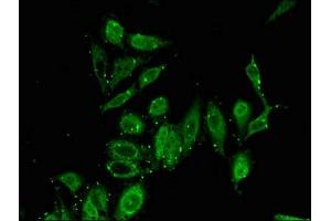 Immunofluorescence (IF) image for anti-Paired-Like Homeodomain 2 (PITX2) (AA 40-154) antibody (ABIN7163465)