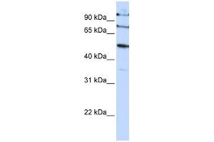 FBXO5 antibody used at 1 ug/ml to detect target protein. (FBXO5 antibody  (C-Term))