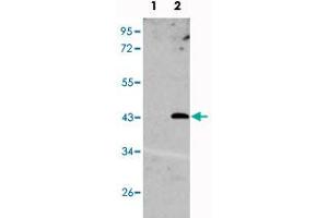 Western blot analysis of UNQ1887 (arrow) using UNQ1887 polyclonal antibody .