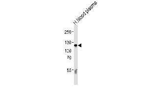 Western blot analysis of lysate from human blood plasma tissue lysate, using C6 Antibody (N-term) (ABIN390924 and ABIN2841126). (C6 antibody  (N-Term))