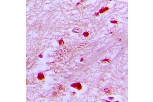 Immunohistochemical analysis of E2F2 staining in human brain formalin fixed paraffin embedded tissue section. (E2F2 antibody  (Center))