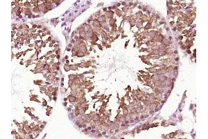 Paraformaldehyde-fixed, paraffin embedded Mouse testis Antigen retrieval by boiling in sodium citrate buffer (pH6. (HSP90AA2 antibody  (AA 401-500))