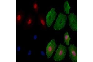 Phospho-hnRNP K (Ser216) Antibody staining A549 cells(4h of LPS treatment) by IF/ICC.