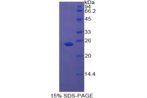 SDS-PAGE analysis of Rat Androgen Receptor Protein. (Androgen Receptor Protein (AR))