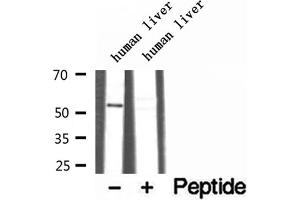 Western blot analysis of extracts of human liver tissue, using TRIM44 antibody. (TRIM44 antibody  (Internal Region))