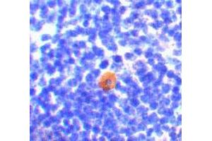 Immunohistochemistry of CARD11 in mouse thymus with CARD11 polyclonal antibody  at 10 ug/mL .