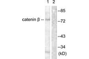 Western blot analysis of extracts from rat brain cells, using Catenin-beta (Ab-654) Antibody. (beta Catenin antibody  (AA 620-669))