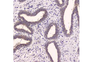 IHC analysis of IDE using anti-IDE antibody . (IDE antibody  (AA 485-756))