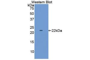 Western blot analysis of the recombinant protein. (LAMC2 antibody  (AA 28-196))