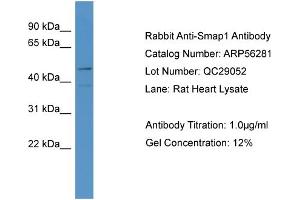 WB Suggested Anti-LOC684800  Antibody Titration: 0. (SMAP1 antibody  (N-Term))