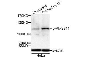 Western blot analysis of extracts of 293 and HeLa cells, using Phospho-Rb-S811 antibody.