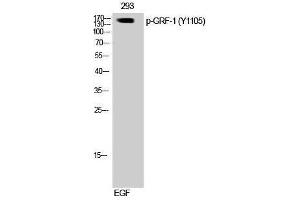 Western Blotting (WB) image for anti-Glucocorticoid Receptor DNA Binding Factor 1 (GRLF1) (pTyr1105) antibody (ABIN3182521) (GRLF1 antibody  (pTyr1105))
