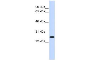 DULLARD antibody used at 1 ug/ml to detect target protein. (CTDNEP1A antibody)