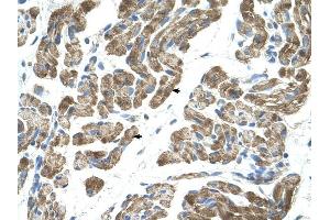 ACVR1 antibody was used for immunohistochemistry at a concentration of 4-8 ug/ml to stain Skeletal muscle cells (arrows) in Human Muscle. (ACVR1 antibody  (N-Term))