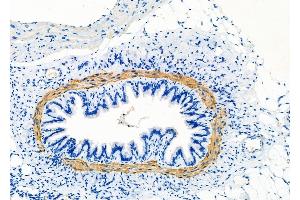 ABIN6260910 and ABIN6277858 at 1/100 staining Rat lung tissue by IHC-P. (Calponin antibody  (N-Term))