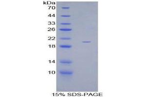 SDS-PAGE (SDS) image for Growth Differentiation Factor 10 (GDF10) (AA 337-477) protein (His tag) (ABIN2125091)