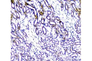 IHC analysis of TANK using anti-TANK antibody (ABIN6719508). (TANK antibody)