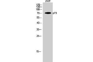 Western Blot (WB) analysis of 293T cells using p73 Polyclonal Antibody. (Tumor Protein p73 antibody  (Tyr220))