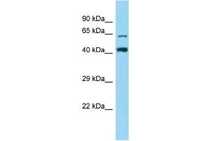 Western Blotting (WB) image for anti-Zinc Finger Protein 667 (ZNF667) (N-Term) antibody (ABIN2778606) (ZNF667 antibody  (N-Term))