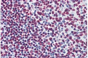 Human Tonsil: Formalin-Fixed, Paraffin-Embedded (FFPE) (BIK antibody  (AA 37-136))