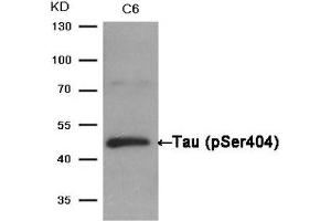 Western Blotting (WB) image for anti-Microtubule-Associated Protein tau (MAPT) (pSer404) antibody (ABIN7138604)