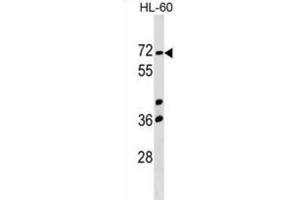 Western Blotting (WB) image for anti-Calicin (CCIN) antibody (ABIN2999591) (Calicin antibody)