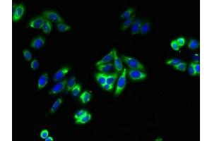 Immunofluorescent analysis of HepG2 cells using ABIN7172961 at dilution of 1:100 and Alexa Fluor 488-congugated AffiniPure Goat Anti-Rabbit IgG(H+L) (TMTC1 antibody  (AA 1-227))